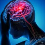 片頭痛を減らす方法。（私の体験談）